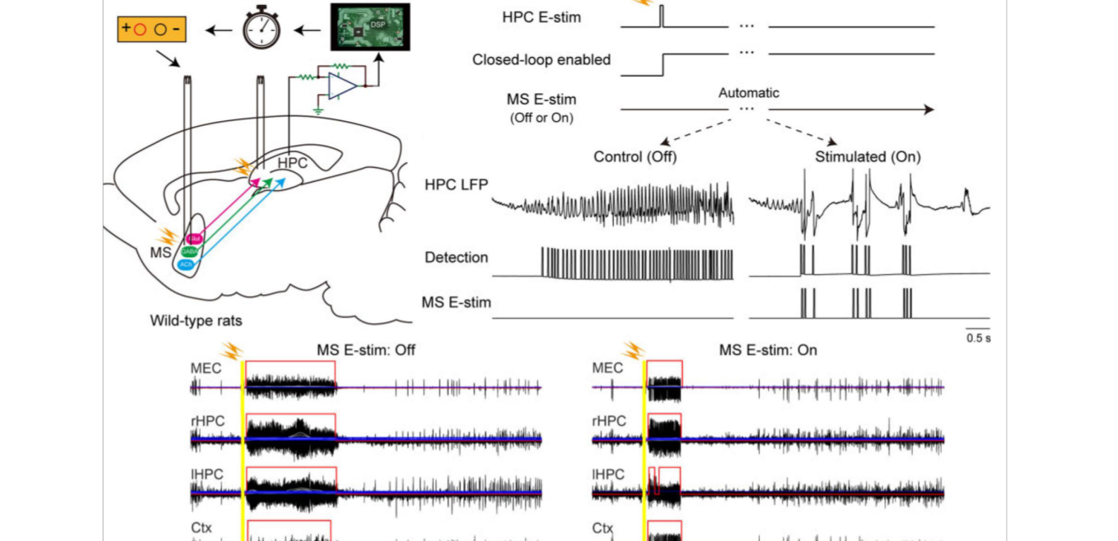 Published experimental methods and electrophysiological traces from Takeuchi et al., Brain (2021).
