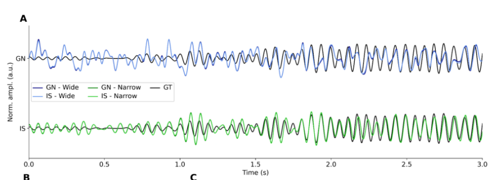 EEG-derived source reconstructions compared with an intracranial reference